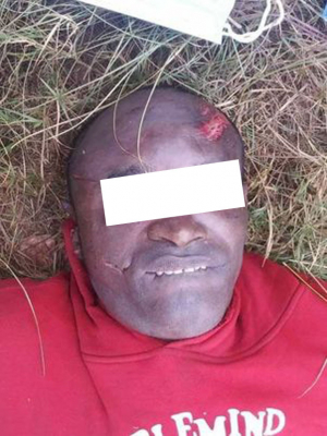 Découverte macabre à Ambatolampy-Tsimahafotsy  - Un meurtre déguisé, selon les gendarmes