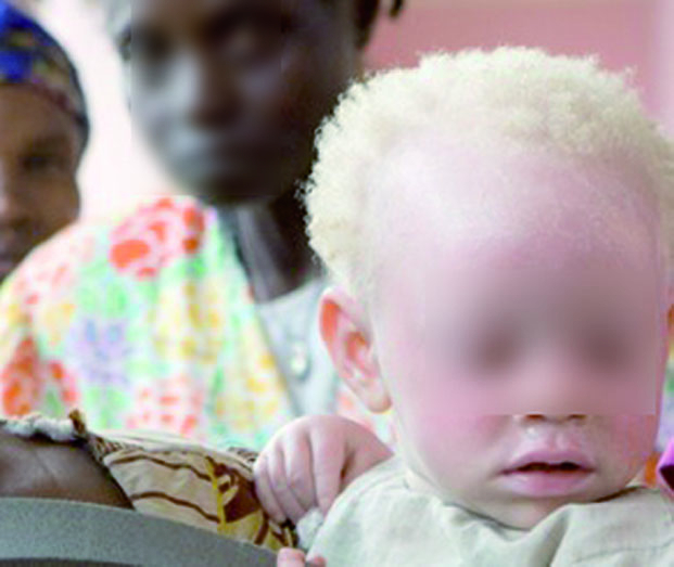 Kidnapping d’enfants albinos - Les commanditaires sur le point d’être démasqués ?